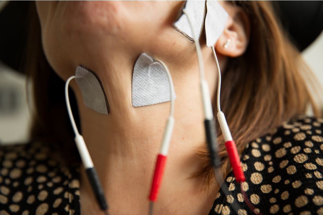 Neuromuscular Electrical Stimulation Trial